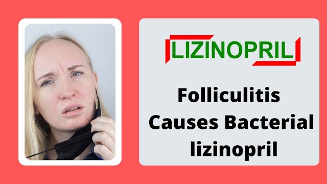 Folliculitis Causes Bacterial Fungal - lizinopril